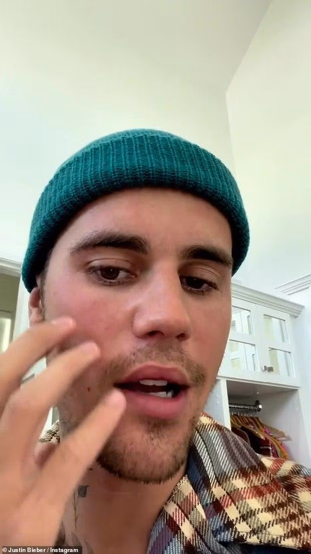 Justin Bieber bị liệt nửa mặt do nhiễm virus hiếm - Ảnh 2.
