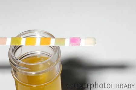 Ảnh minh họa - Sciencephoto