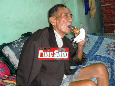 Ông Mừng ăn uống khỏe mạnh bình thường và hồi phục nhanh 