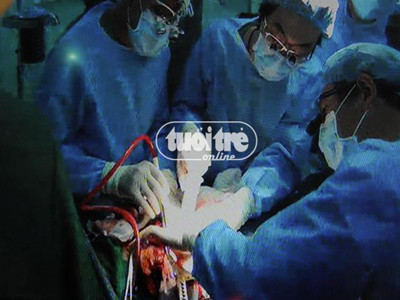 Các bác sĩ đang tách phần gan của người nhận (ảnh chụp qua màn hình tivi sáng 12-10). Ảnh: Minh Đức (Tuổi Trẻ) Các bác sĩ đang tách phần gan của người nhận (ảnh chụp qua màn hình tivi sáng 12-10)