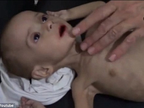 Trẻ em Syria đang chịu nhiều thống khổ. Bé gái này chết vì bị bỏ đói quá lâu. Ảnh: YouTube