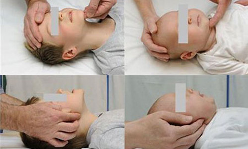 Một trong những thao tác sơ cứu khi trẻ bị hóc dị vật. Nâng cằm (hình trên) và đẩy hàm (hình dưới)