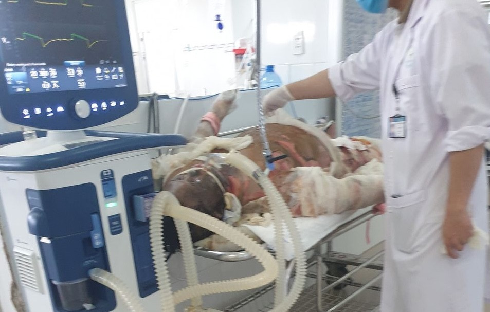 Bác sĩ kiểm tra sức khoẻ của một nạn nhân trong vụ cháy ở Ninh Thuận. Ảnh: Vy Vy.