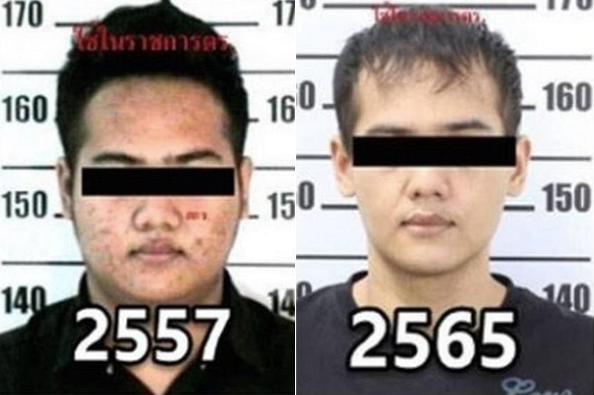 Tay buôn ma tuý Sarahat Sawangjaeng trước và sau khi phẫu thuật Tay buôn ma tuý Sarahat Sawangjaeng trước và sau khi phẫu thuật