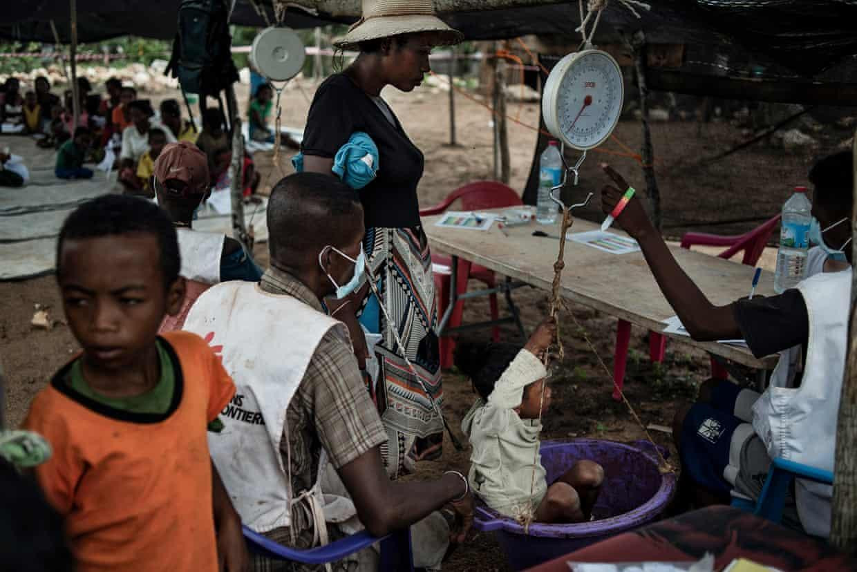 Vokasoa Origin quan sát con gái cô, Bakoly, được cân. Em sau đó được xếp vào nhóm suy dinh dưỡng nặng