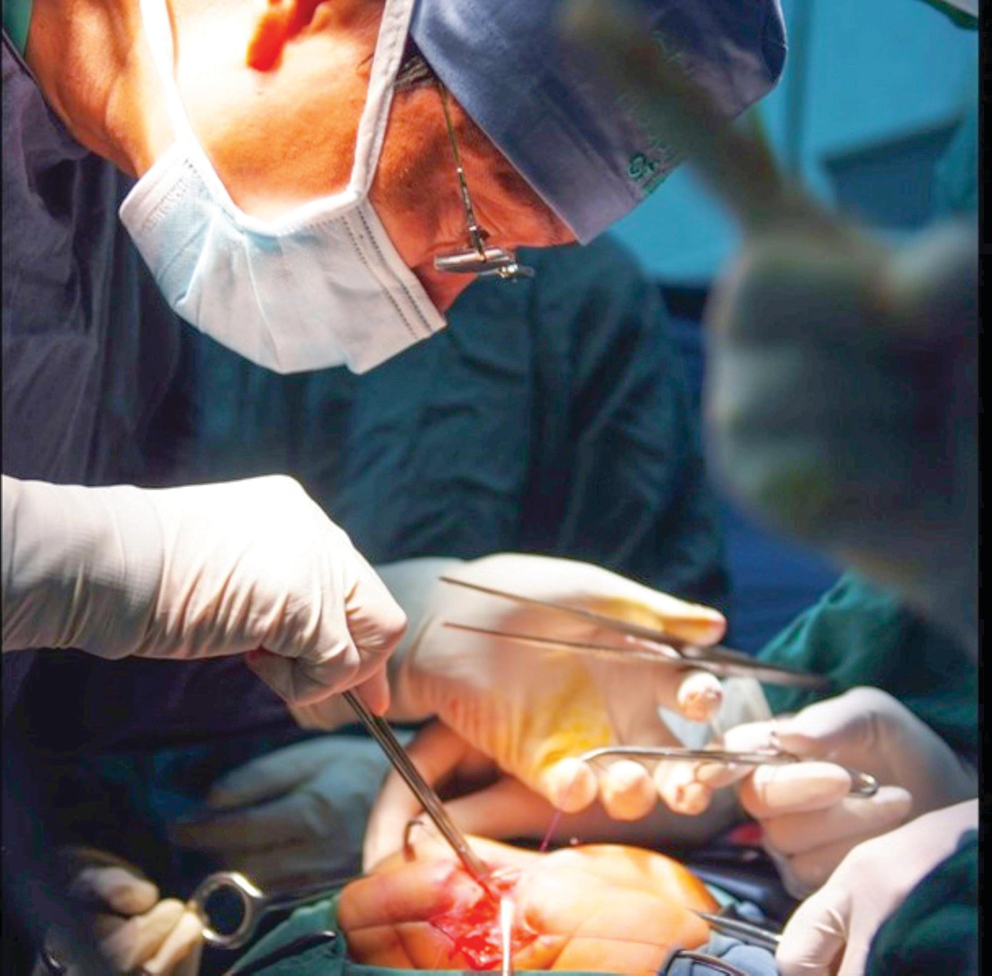 GS.TS Nguyễn Thanh Liêm trong một ca phẫu thuật GS.TS Nguyễn Thanh Liêm trong một ca phẫu thuật