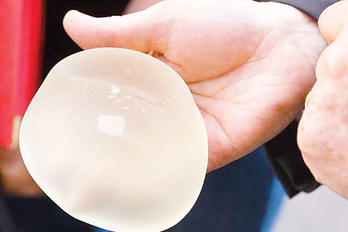 Hàng trăm ngàn phụ nữ trên thế giới đã được ghép túi nâng ngực PIP - Ảnh: Europe 1. Hàng trăm ngàn phụ nữ trên thế giới đã được ghép túi nâng ngực PIP - Ảnh: Europe 1