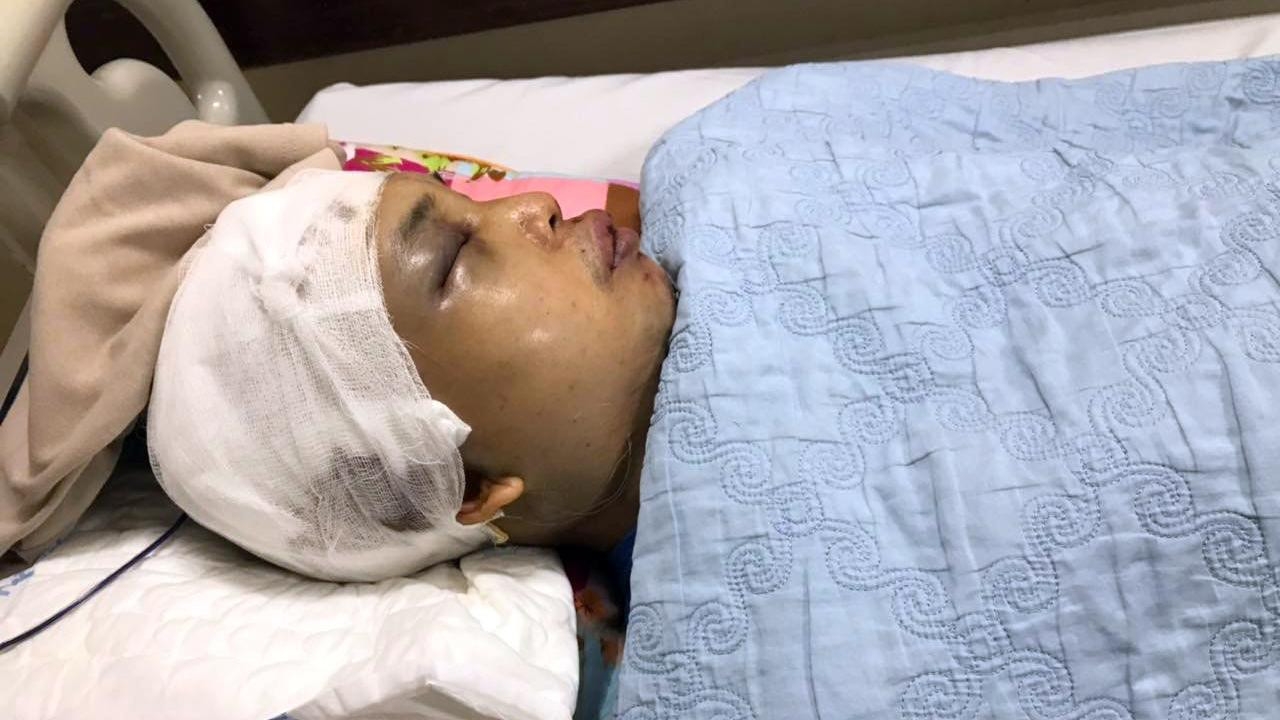 Ông Nguyễn Văn Hanh - Phó Chủ tịch UBND xã An Thượng (TP Hải Dương) đang được cấp cứu, điều trị tại Bệnh viện Việt Đức.