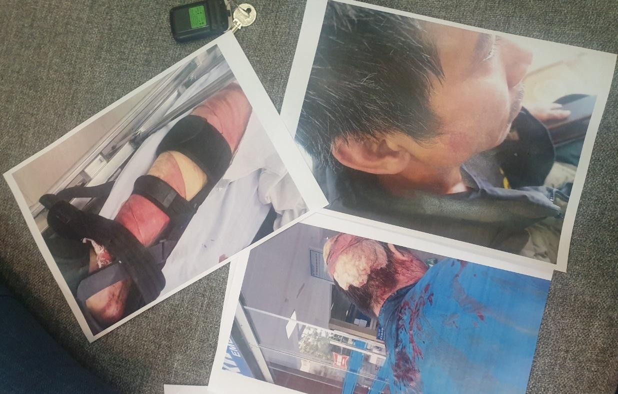 Các ngư dân nhập viện cấp cứu sau vụ việc