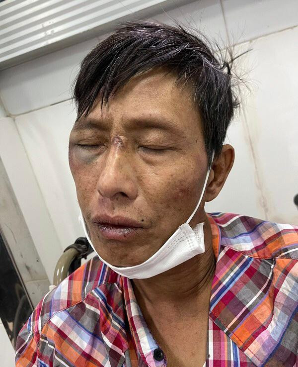 Đối tượng Vũ Văn Nguyên tại cơ quan công an. Ảnh: CAHP Đối tượng Vũ Văn Nguyên tại cơ quan công an. Ảnh: CAHP