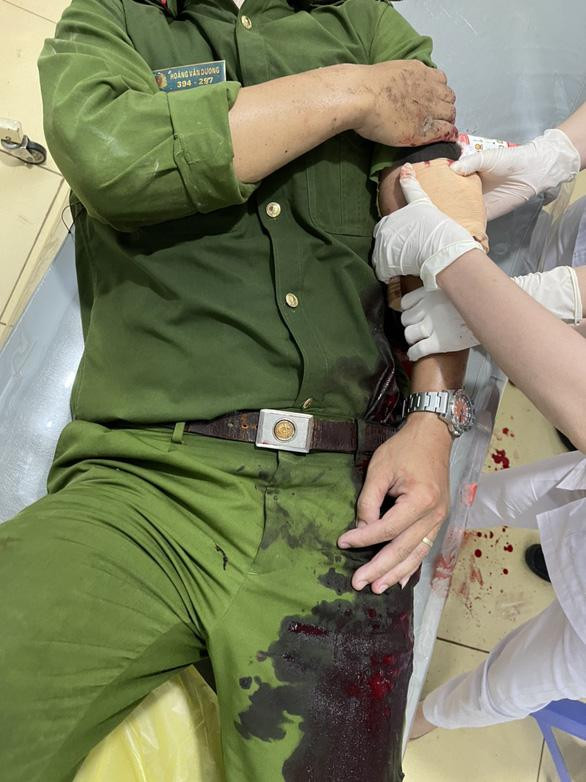Thượng úy Hoàng Văn Dương bị thương ở cánh tay trái do Bảo dùng rựa chém. Ảnh: Công an cung cấp.