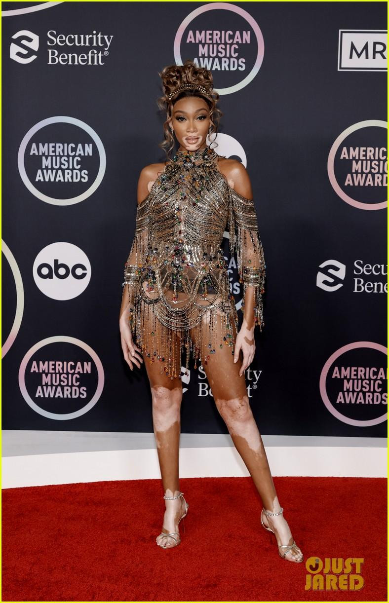 Winnie Harlow nóng bỏng trong chiếc váy nạm ngọc “hở bạo” của nhà mốt Lebanon Zuhair Murad, kết hợp giày cao gót buộc dây và vương miện đội đầu. Winnie Harlow nóng bỏng trong chiếc váy nạm ngọc “hở bạo” của nhà mốt Lebanon Zuhair Murad, kết hợp giày cao gót buộc dây và vương miện đội đầu.