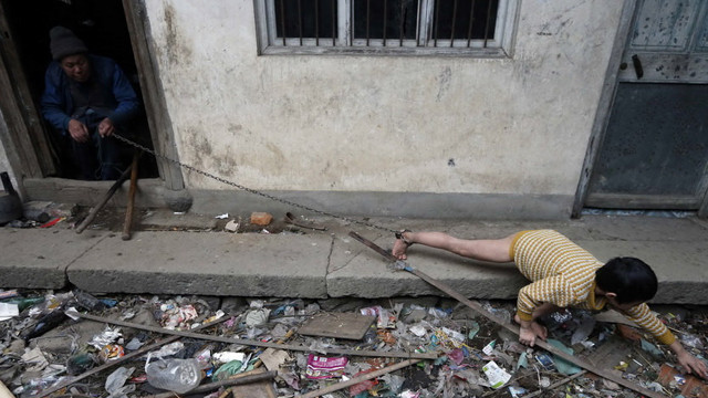 Gia cảnh nghèo khó của cậu bé bị tổn thương não . Gia cảnh nghèo khó của cậu bé bị tổn thương não