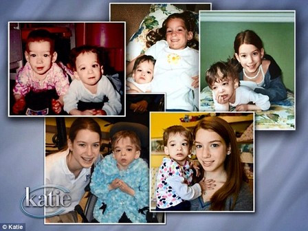 Em gái Carly của Brooke vẫn phát triển bình thường