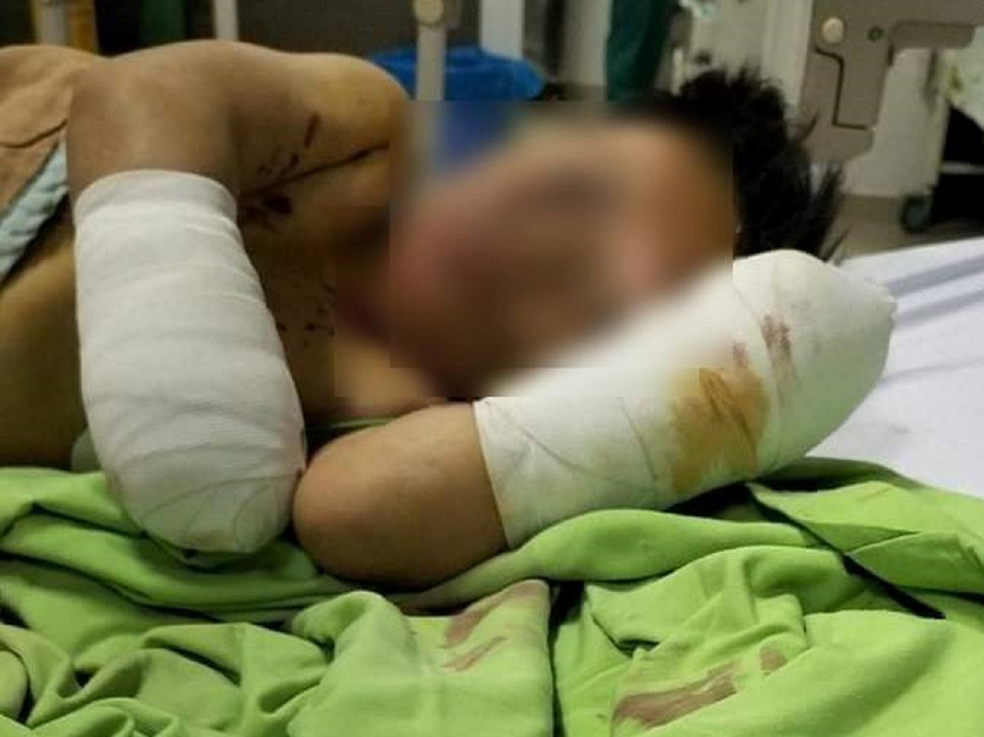 Cháu C. đang được điều trị tại bệnh viện