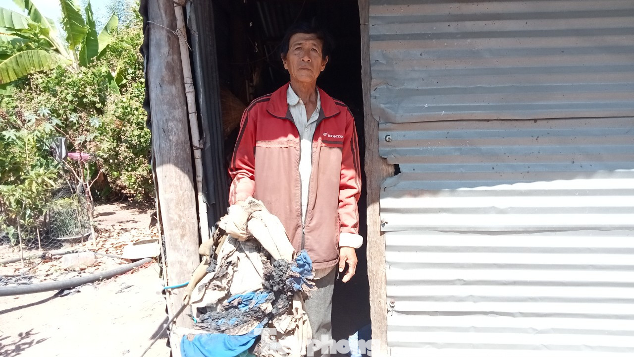 Ông Bên bên đống quần áo bị cháy do hiện tượng &quot;tự cháy&quot; gây ra