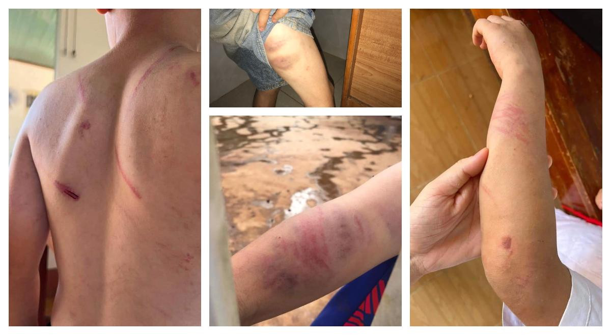 Người bố thừa nhận nhiều lần đánh con