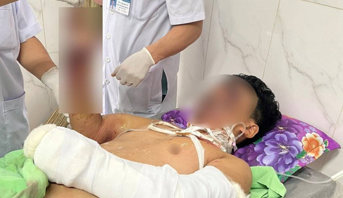 Một học sinh bị thương nặng do pháo nổ Một học sinh bị thương nặng do pháo nổ