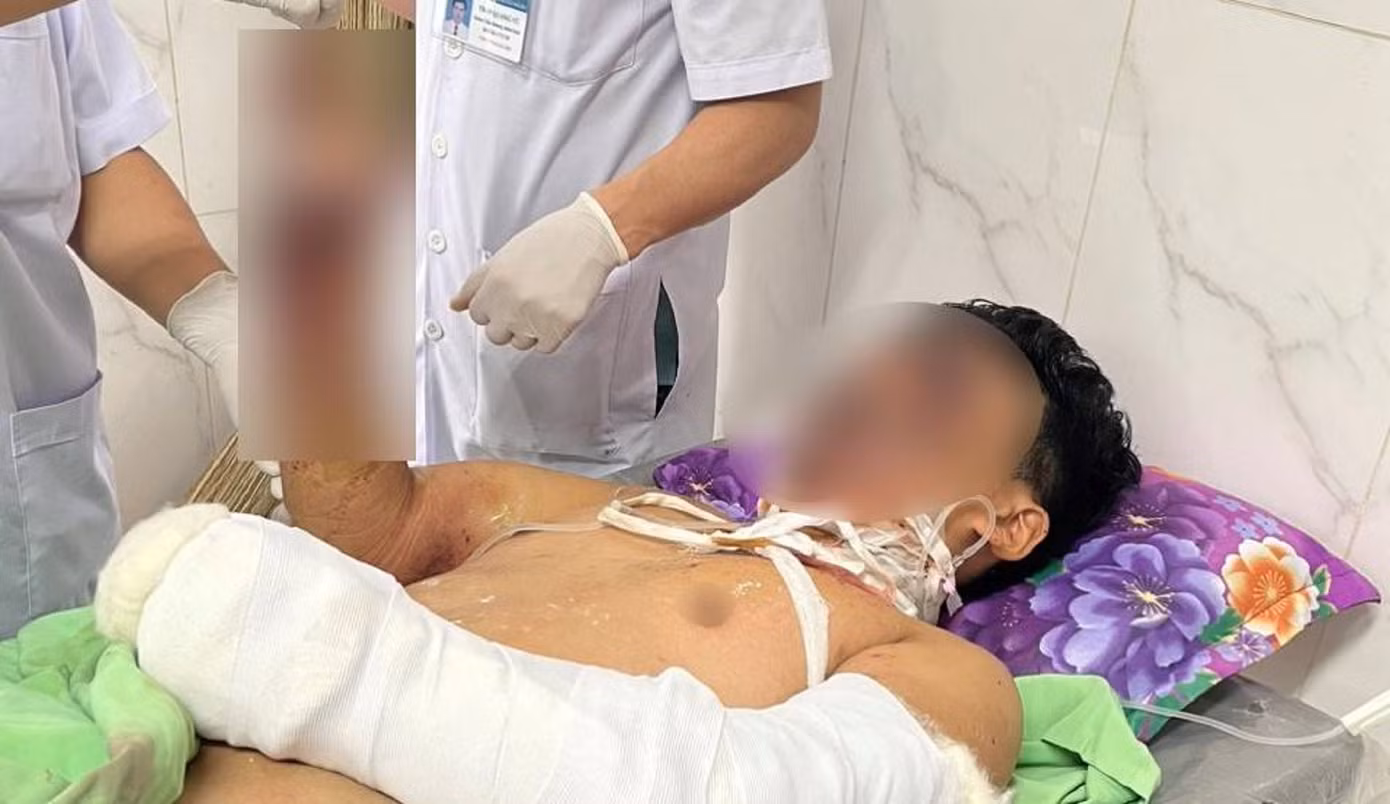 Một học sinh bị thương nặng do pháo nổ Một học sinh bị thương nặng do pháo nổ