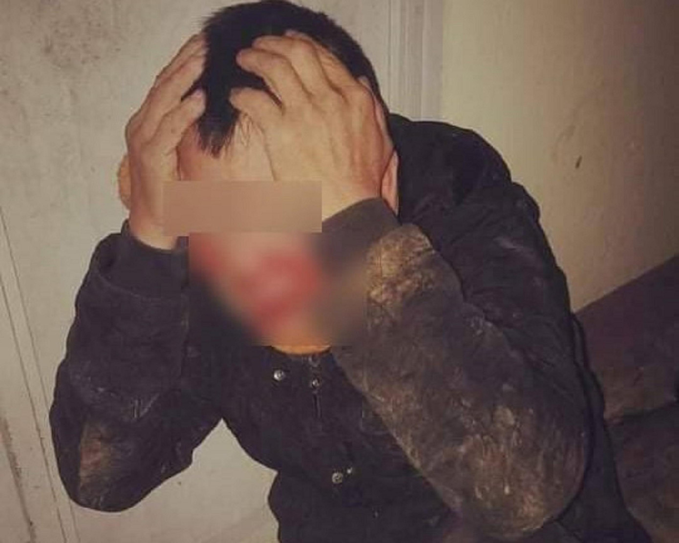 Hình ảnh P. ôm đầu, mặt be bét máu được lan truyền trên mạng xã hội Hình ảnh P. ôm đầu, mặt be bét máu được lan truyền trên mạng xã hội