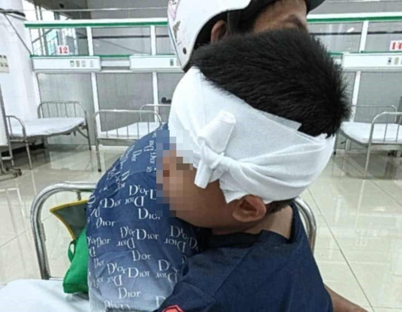 Cháu Y.L.S. phải vào viện sau khi bị tai nạn.