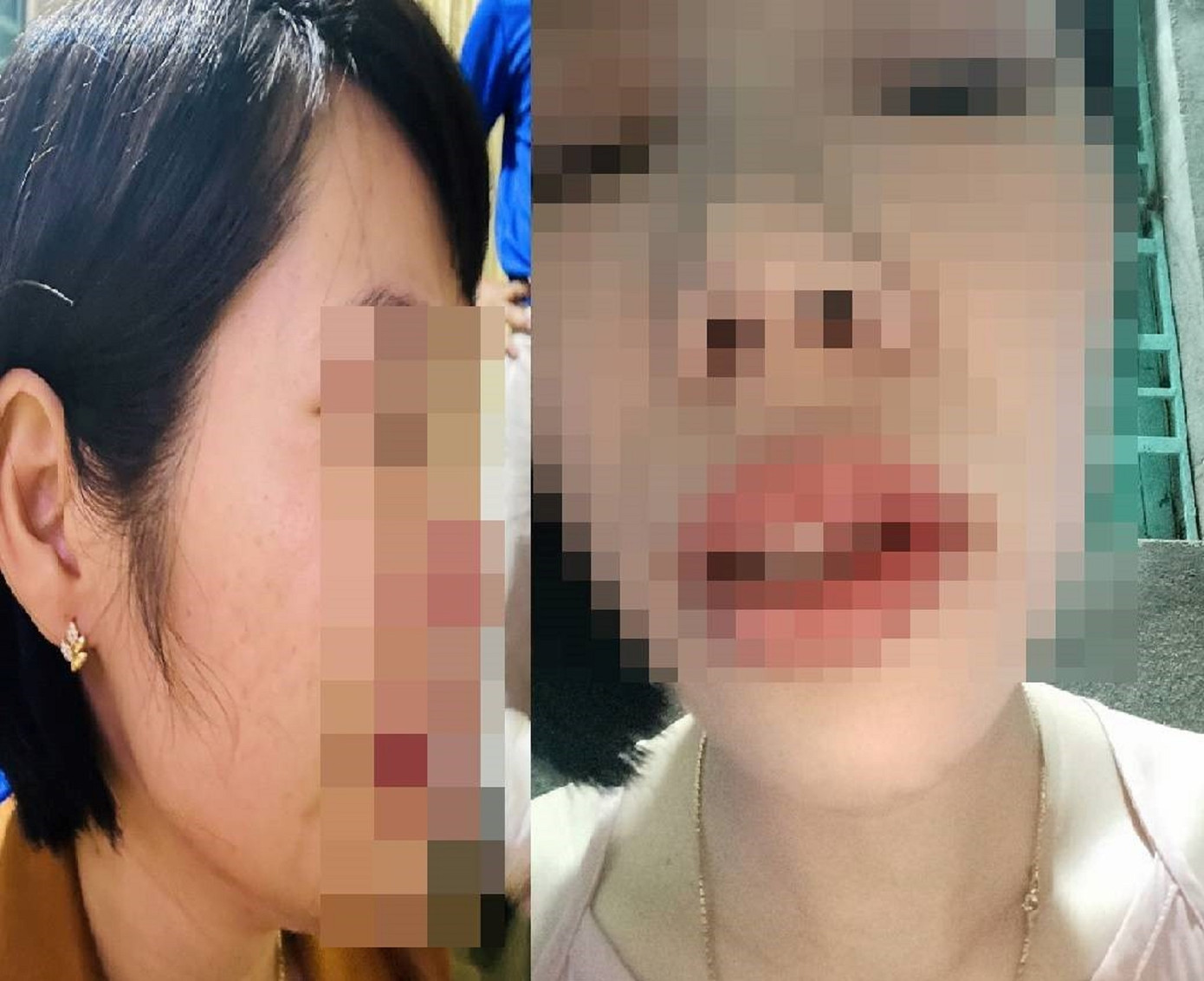 Cô giáo Q. bị phụ huynh học sinh (đang làm thầy giáo ở một trường THCS trên địa bàn) lao vào nhà hành hung. Cô giáo Q. bị phụ huynh học sinh (đang làm thầy giáo ở một trường THCS trên địa bàn) lao vào nhà hành hung.