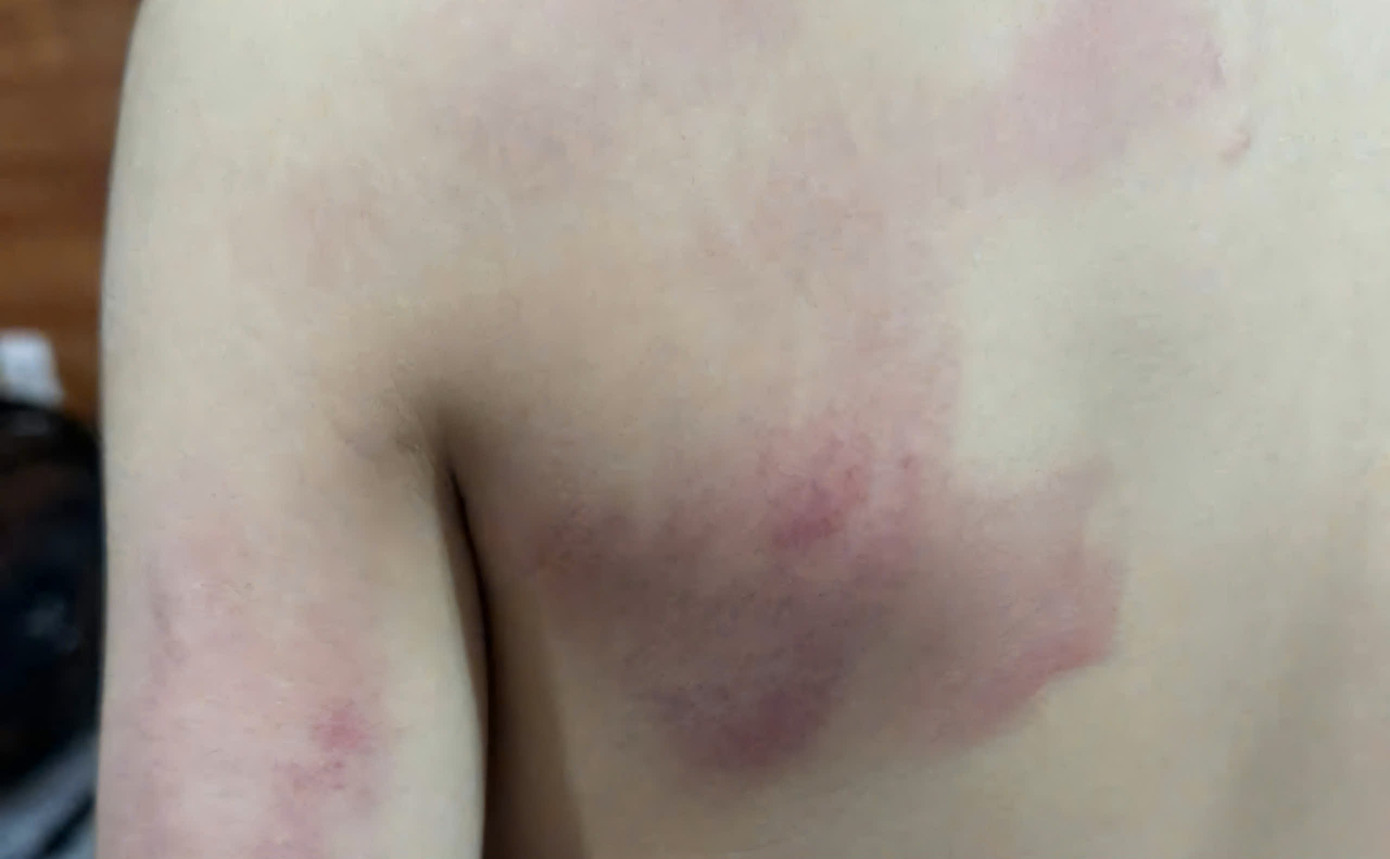 Cô giáo dùng thước phạt học sinh Cô giáo dùng thước phạt học sinh