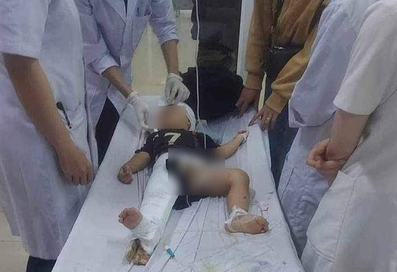 Cháu Ph. bị thương nặng.