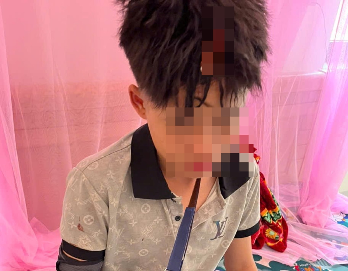 Nam sinh lớp 10 bị đánh vỡ đầu, gãy tay Nam sinh lớp 10 bị đánh vỡ đầu, gãy tay