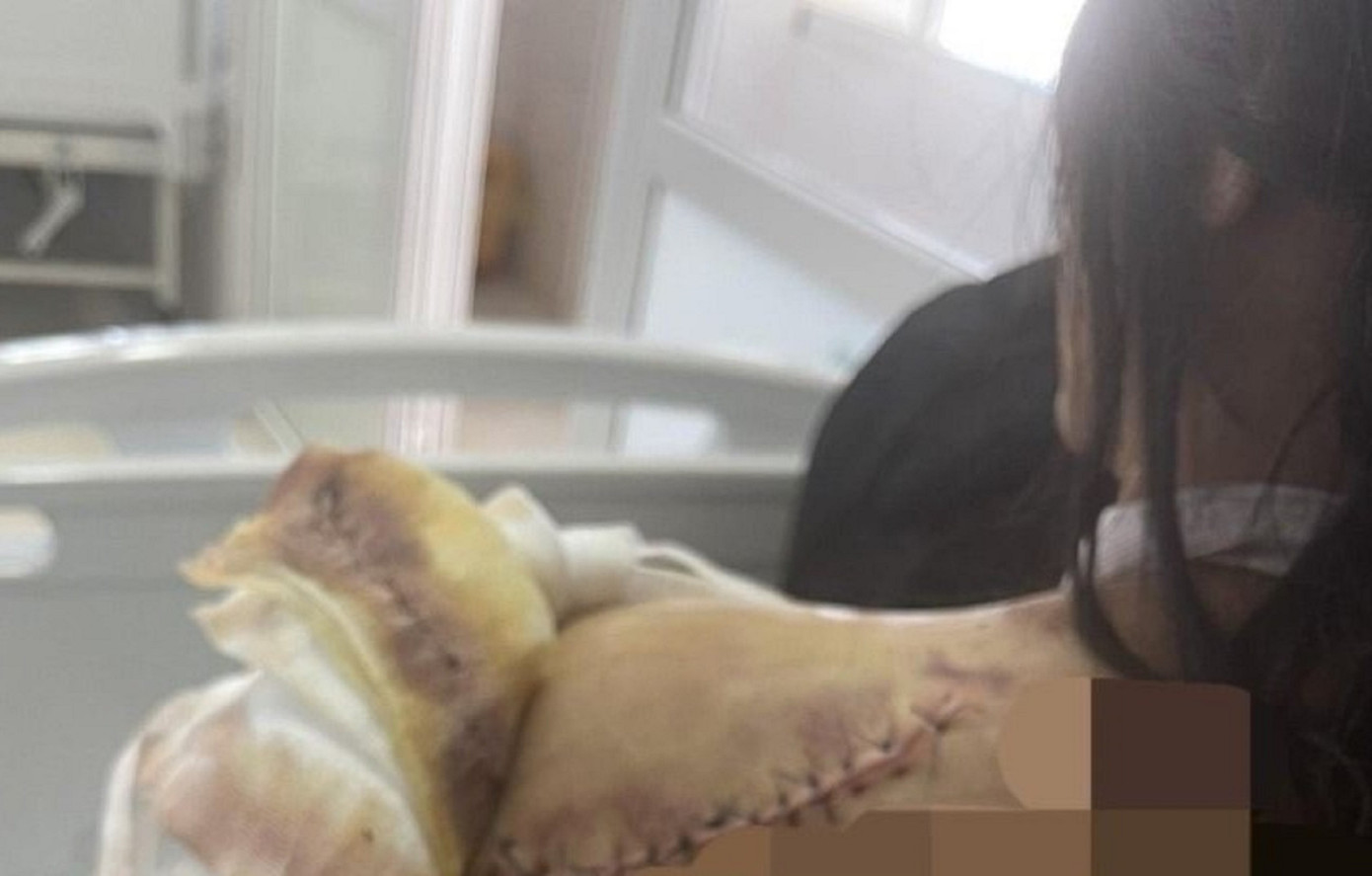 Bà H. từng bị đối tượng Thiện tấn công