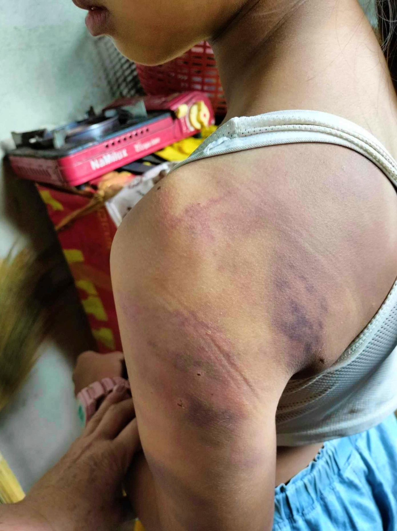 Những vết tích trên người em U. Những vết tích trên người em U.