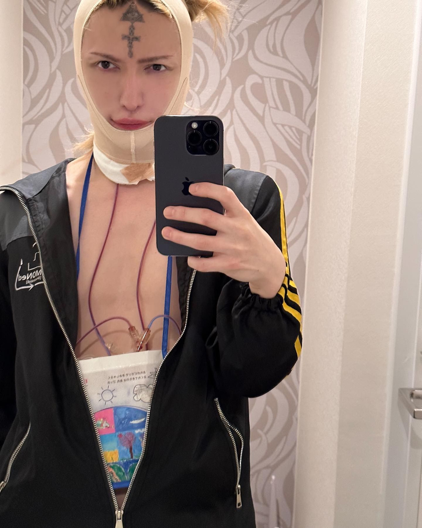 Người hâm mộ lo lắng trước những biểu hiện nghiện "dao kéo" của MiA. Ảnh: IG.