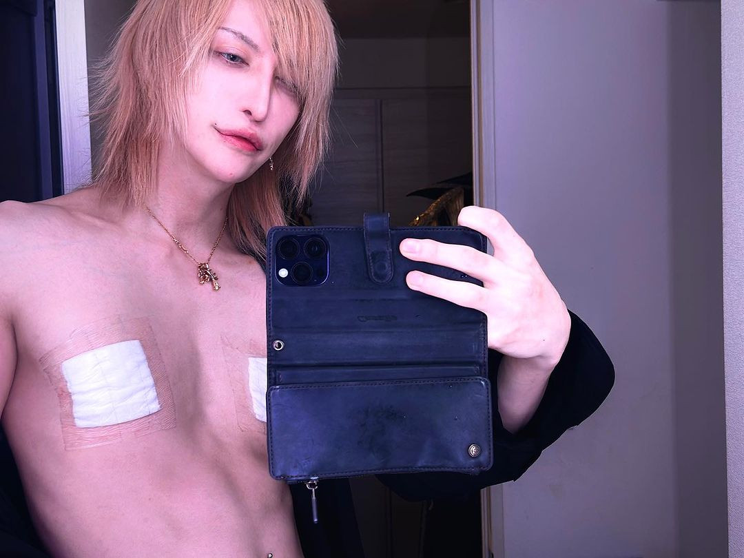 MiA cắt bỏ đầu ngực vì thấy không cần thiết và gây ảnh hưởng cho việc tập trung chơi đàn guitar. Ảnh: IG.