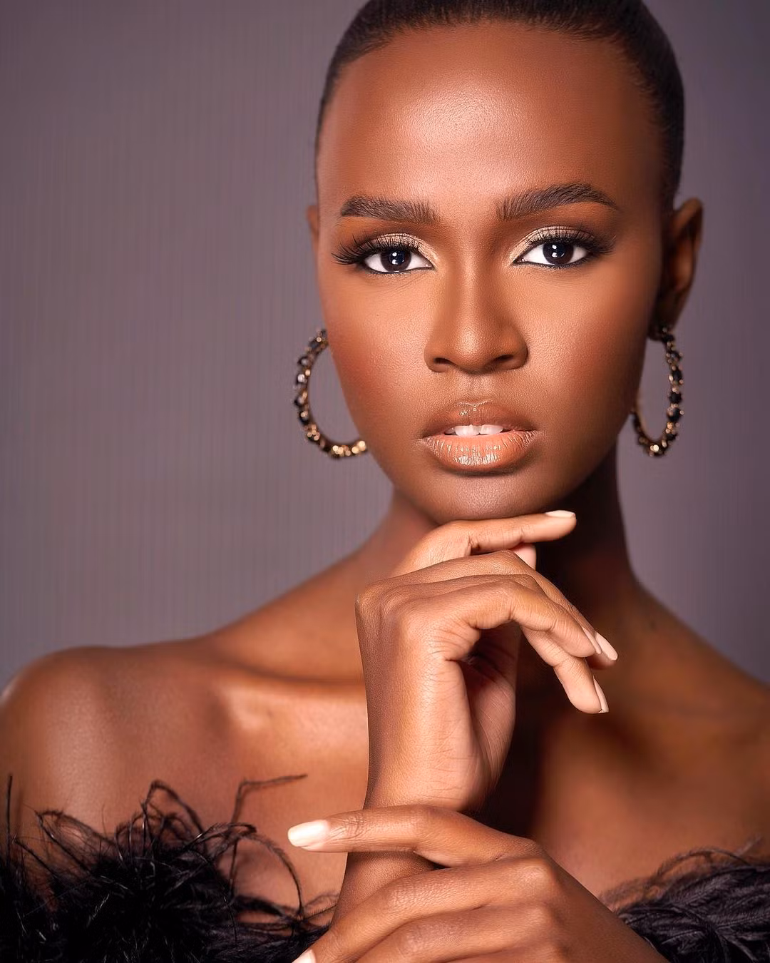 Sau khi giành chiến thắng ở phần thi Top Model, Axelle được nhận xét là một trong những thí sinh tiềm năng của khu vực châu Mỹ.