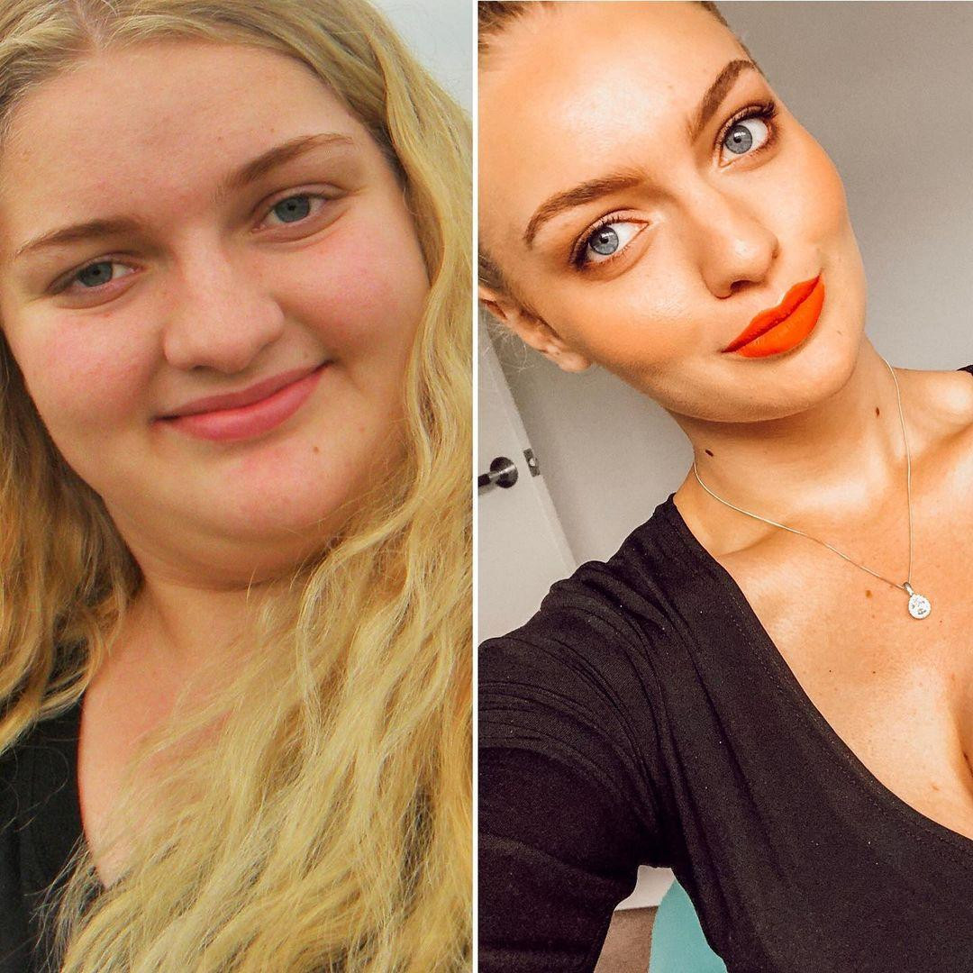 Đăng những bức ảnh chính mình trước và sau giảm cân, Josephine Desgrand thực sự "gây sốt" cộng đồng mạng.