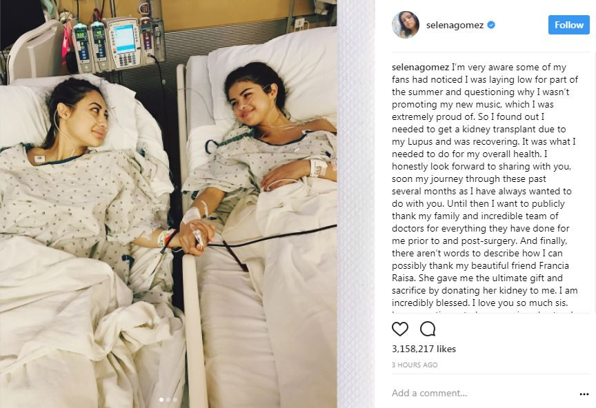 Selena Gomez được chuẩn đoán mắc bệnh Lupus ban đỏ và phải thực hiện phẫu thuật ghép thận vào năm 2017. Selena Gomez được chuẩn đoán mắc bệnh Lupus ban đỏ và phải thực hiện phẫu thuật ghép thận vào năm 2017.