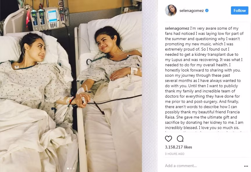 Selena Gomez được chuẩn đoán mắc bệnh Lupus ban đỏ và phải thực hiện phẫu thuật ghép thận vào năm 2017.