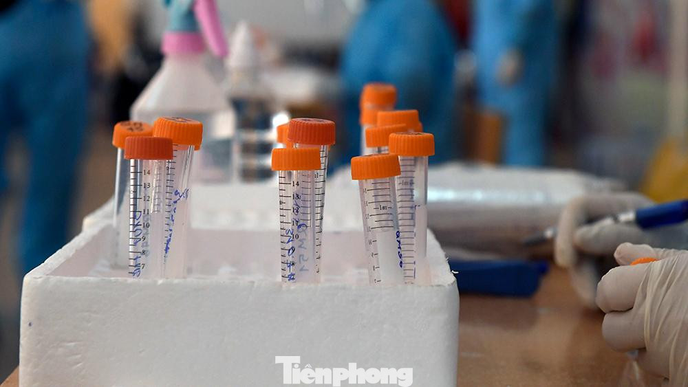 Theo thông tin từ Sở Y tế Hà Nội, từ 12 giờ ngày 31/7 đến 18 giờ ngày 31/7, thành phố ghi nhận 25 ca dương tính SARS-CoV-2, trong đó có 4 ca phát hiện tại khu cách ly và 21 ca phát hiện tại cộng đồng.