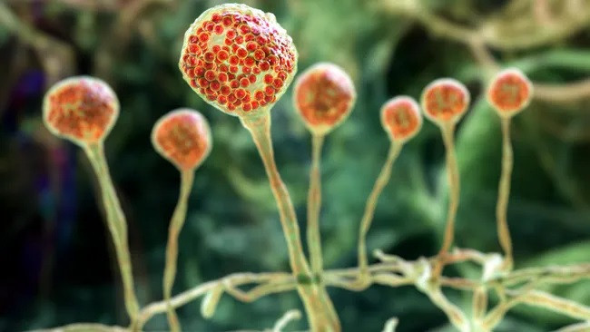 Bệnh nấm mucormycosis là một bệnh nhiễm trùng hiếm gặp nhưng có khả năng gây tử vong do một nhóm nấm được gọi là mucormycetes gây ra. (Ảnh: Kateryna Kon) Bệnh nấm mucormycosis là một bệnh nhiễm trùng hiếm gặp nhưng có khả năng gây tử vong do một nhóm nấm được gọi là mucormycetes gây ra. (Ảnh: Kateryna Kon)