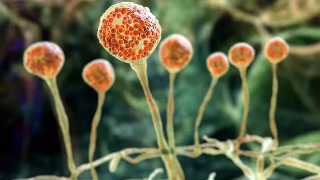 Bệnh nấm mucormycosis là một bệnh nhiễm trùng hiếm gặp nhưng có khả năng gây tử vong do một nhóm nấm được gọi là mucormycetes gây ra. (Ảnh: Kateryna Kon)