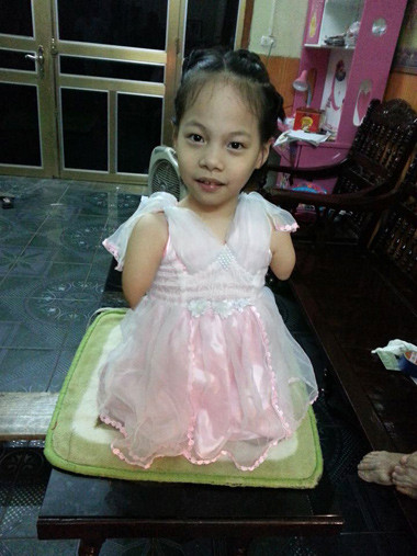 Cô bé không tay không chân Nguyễn Linh Chi. Ảnh: NVCC
