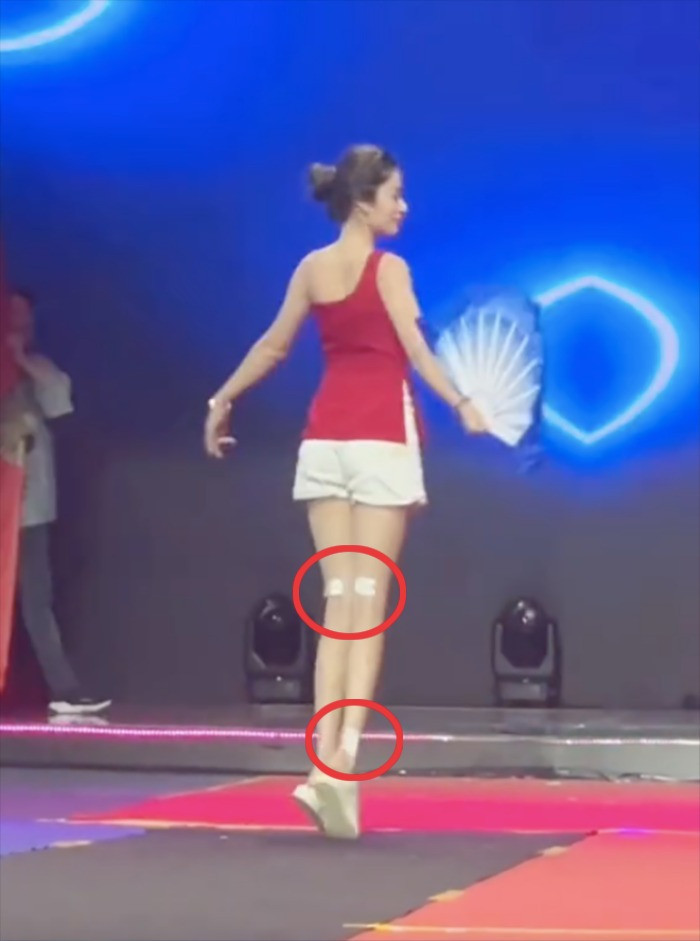 Cô phải dán nhiều miếng dán giảm đau trong buổi tổng duyệt. Cô phải dán nhiều miếng dán giảm đau trong buổi tổng duyệt.