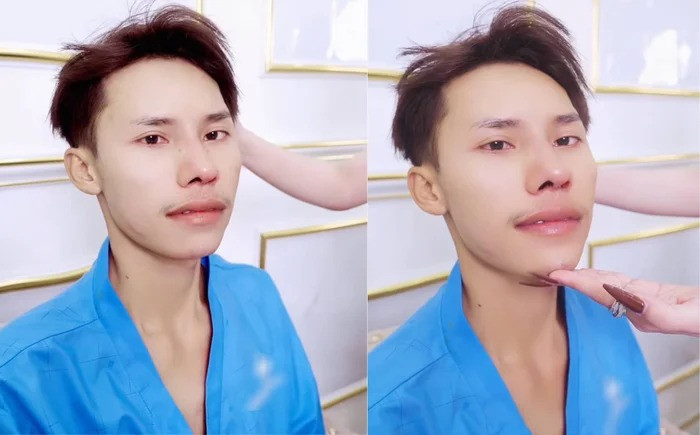 Lai Thai sang Việt Nam để chỉnh sửa diện mạo.