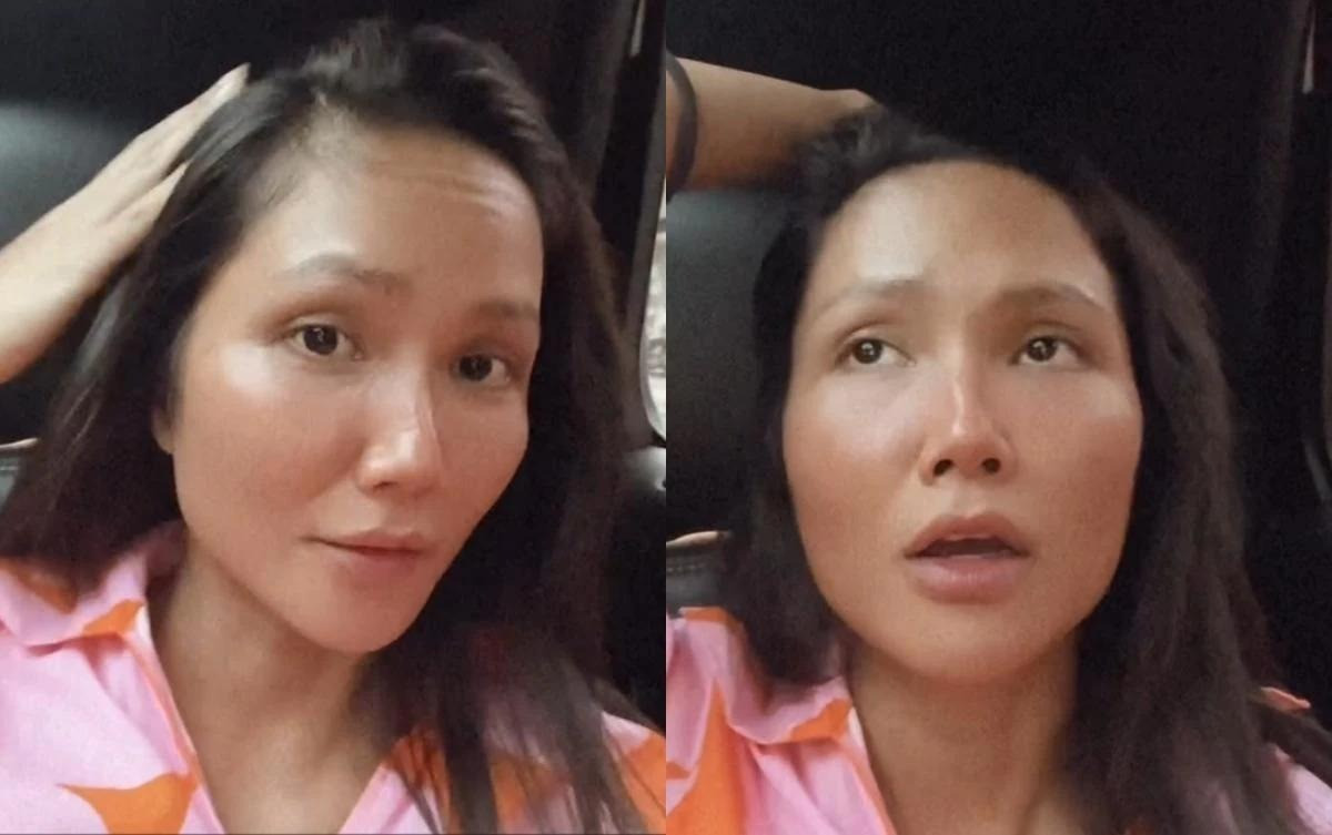 H'Hen Niê từng tiết lộ bị rụng tóc nhiều do căng thẳng. H'Hen Niê từng tiết lộ bị rụng tóc nhiều do căng thẳng.