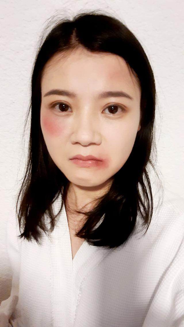 Diễn viên Thanh Hòa hé lộ gương mặt bầm tím trong cảnh quay này. Diễn viên Thanh Hòa hé lộ gương mặt bầm tím trong cảnh quay này.