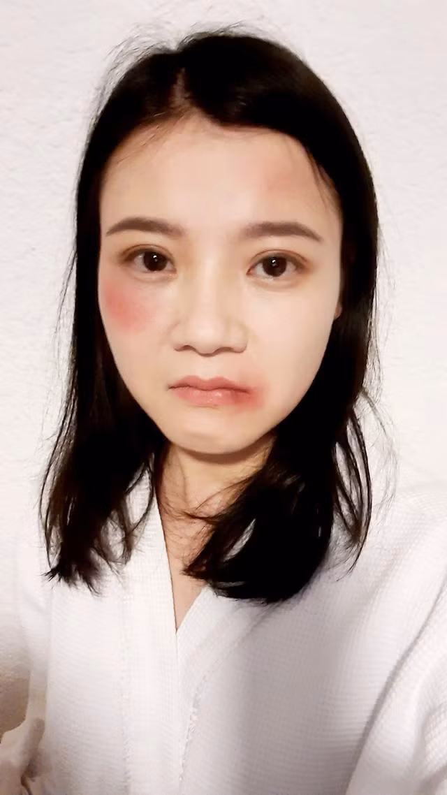 Diễn viên Thanh Hòa hé lộ gương mặt bầm tím trong cảnh quay này.