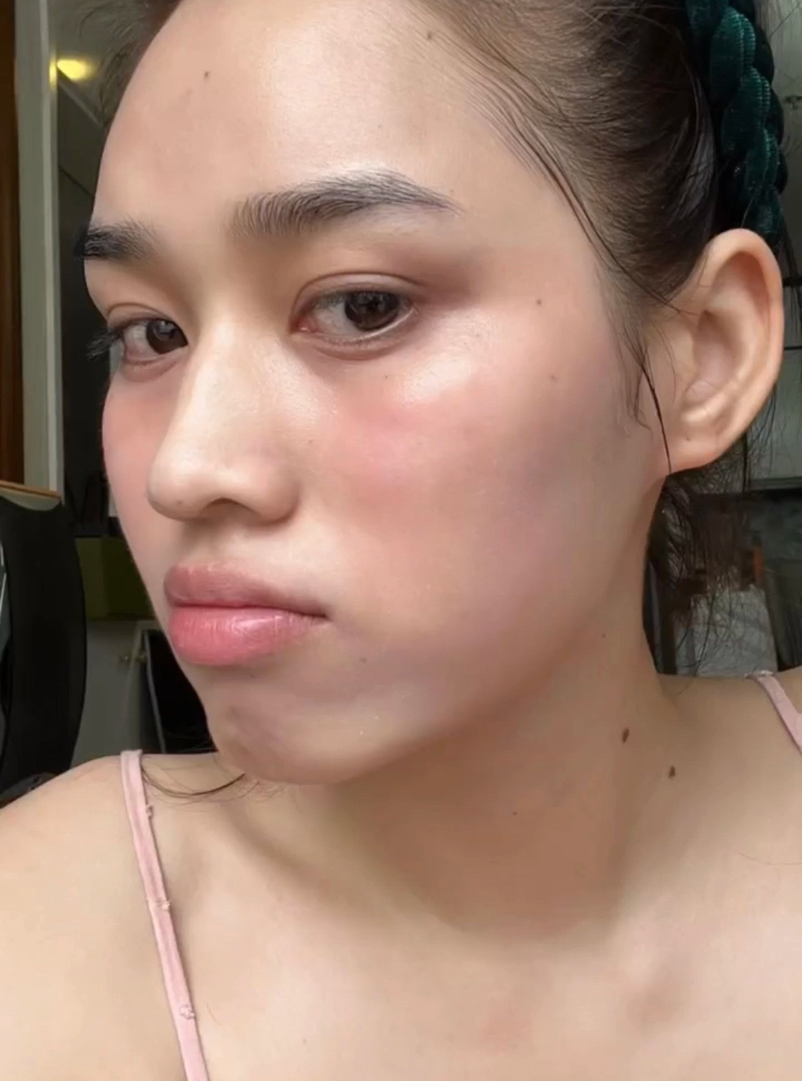 Nàng hậu bị kích ứng sau hai lần bôi. Nàng hậu bị kích ứng sau hai lần bôi.