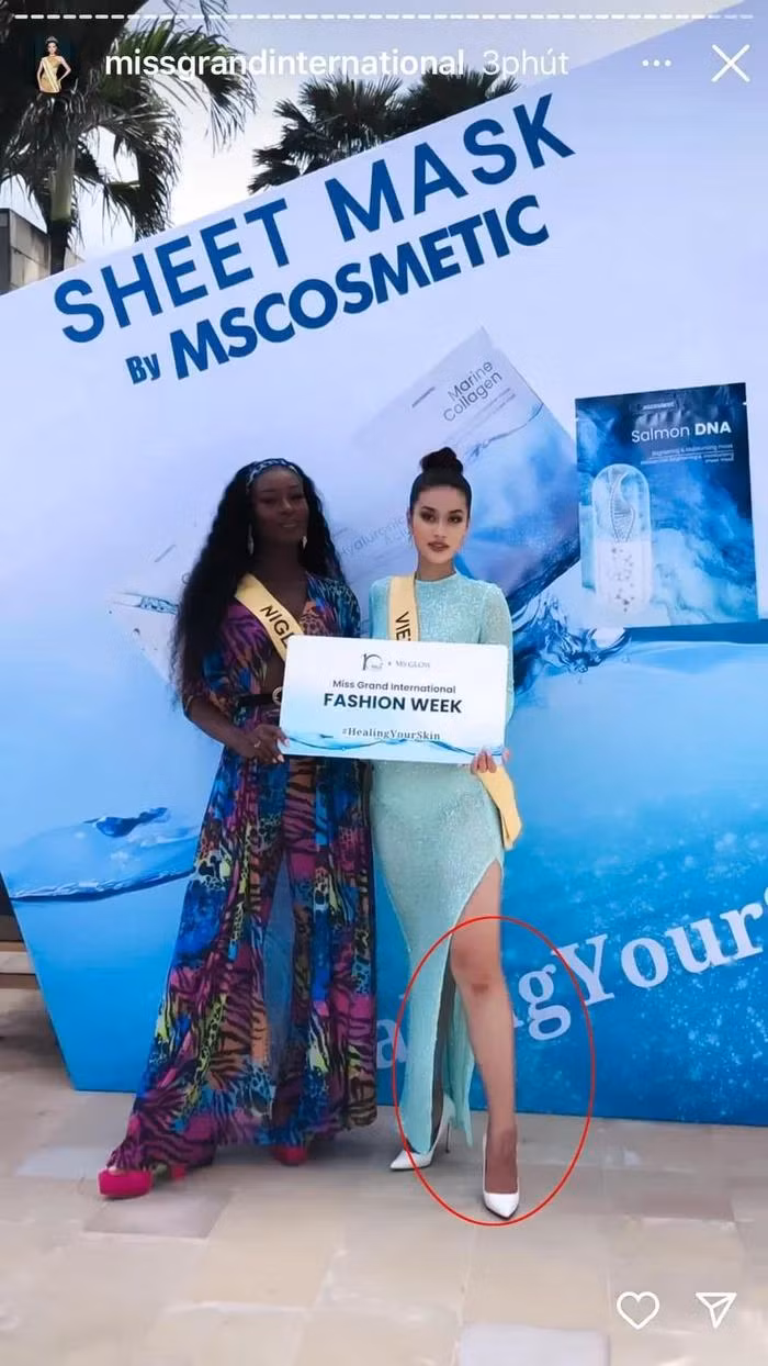Vết thương của cô vẫn chưa lành khi tham dự Miss Grand International 2022.