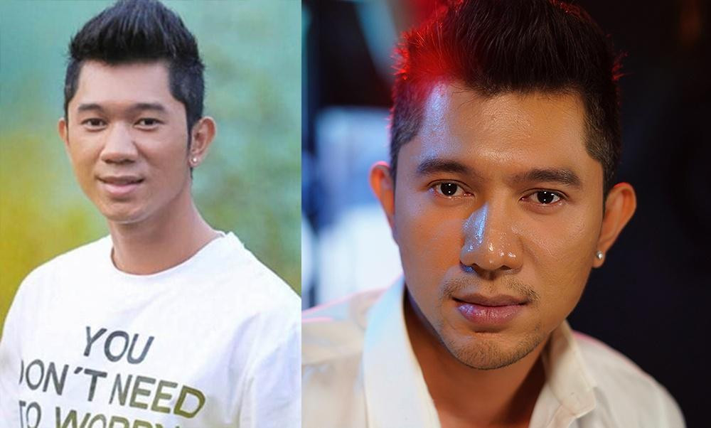 Lương Bằng Quang trước và sau khi thẩm mỹ. Lương Bằng Quang trước và sau khi thẩm mỹ.