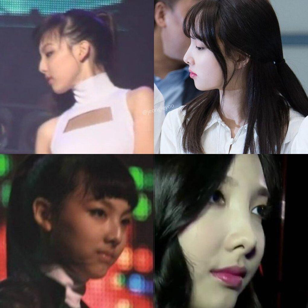 Nayeon (TWICE) bị nghi ngờ chỉnh hàm và mũi Nayeon (TWICE) bị nghi ngờ chỉnh hàm và mũi